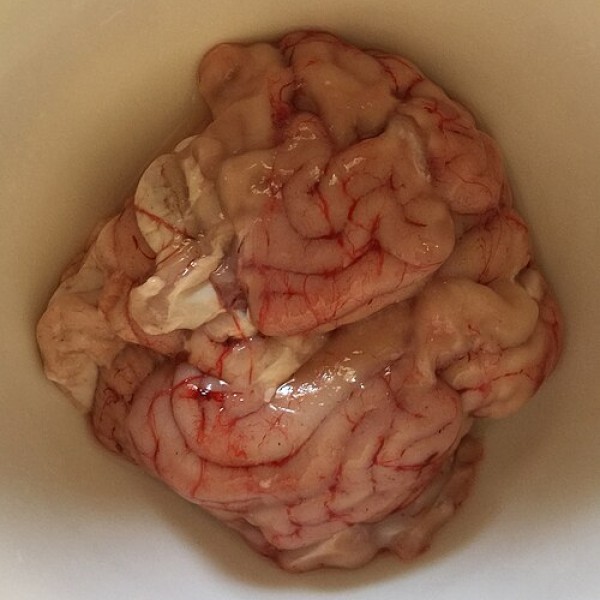 Brain